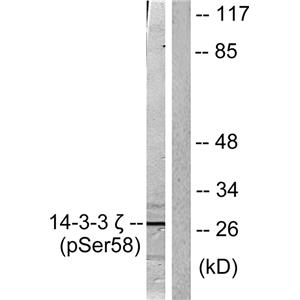 14-3-3 ζ (phospho Ser58)兔多抗,14-3-3 ζ (phospho Ser58) Rabbit Polyclonal Antibody