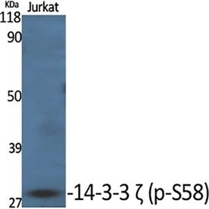 14-3-3 ζ (phospho Ser58)兔多抗,14-3-3 ζ (phospho Ser58) Rabbit Polyclonal Antibody