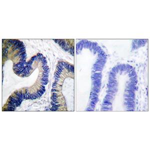 4E-BP1 (phospho Ser65)兔多抗,4E-BP1 (phospho Ser65) Rabbit Polyclonal Antibody