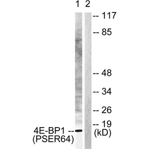 4E-BP1 (phospho Ser65)兔多抗,4E-BP1 (phospho Ser65) Rabbit Polyclonal Antibody