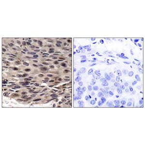 4E-BP1 (phospho Thr37)兔多抗,4E-BP1 (phospho Thr37) Rabbit Polyclonal Antibody