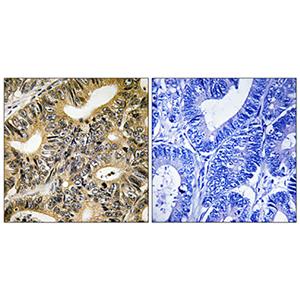 4E-BP1 (phospho Thr70)兔多抗,4E-BP1 (phospho Thr70) Rabbit Polyclonal Antibody