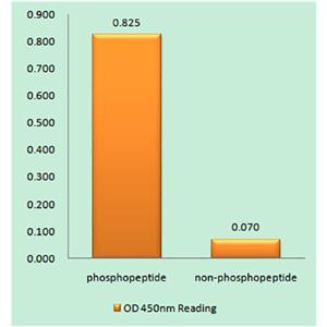 ALK (phospho Tyr1507)兔多抗,ALK (phospho Tyr1507) Rabbit Polyclonal Antibody
