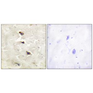 ALK (phospho Tyr1507)兔多抗,ALK (phospho Tyr1507) Rabbit Polyclonal Antibody