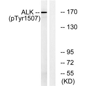 ALK (phospho Tyr1507)兔多抗,ALK (phospho Tyr1507) Rabbit Polyclonal Antibody