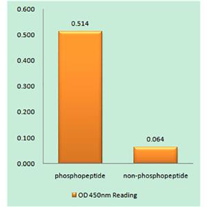 Amyloid-β (phospho Thr743)兔多抗,Amyloid-β (phospho Thr743) Rabbit Polyclonal Antibody
