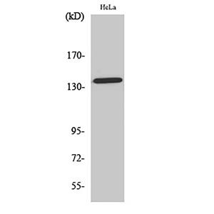 Amyloid-β (phospho Thr743)兔多抗,Amyloid-β (phospho Thr743) Rabbit Polyclonal Antibody