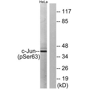 AP-1 (phospho Ser63)兔多抗,AP-1 (phospho Ser63) Rabbit Polyclonal Antibody
