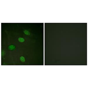 AP-1 (phospho Thr231)兔多抗,AP-1 (phospho Thr231) Rabbit Polyclonal Antibody