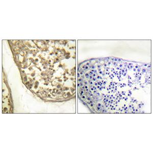AP-1 (phospho Thr231)兔多抗,AP-1 (phospho Thr231) Rabbit Polyclonal Antibody