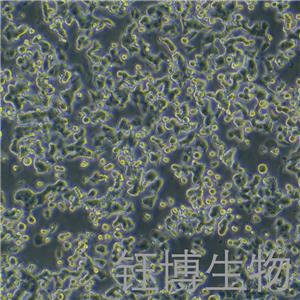 NCI-H810（人非小细胞肺癌细胞）YB-72022HC