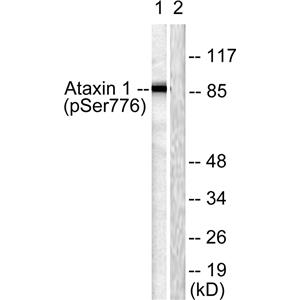 Ataxin-1 (phospho Ser776)兔多抗,Ataxin-1 (phospho Ser776) Rabbit Polyclonal Antibody