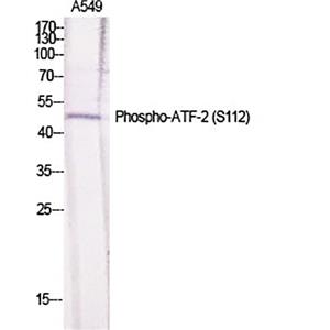 ATF-2 (phospho Ser112)兔多抗,ATF-2 (phospho Ser112) Rabbit Polyclonal Antibody