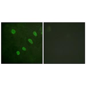 ATF-2 (phospho Ser480)兔多抗,ATF-2 (phospho Ser480) Rabbit Polyclonal Antibody