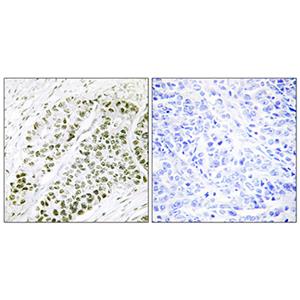 ATF-2 (phospho Ser480)兔多抗,ATF-2 (phospho Ser480) Rabbit Polyclonal Antibody