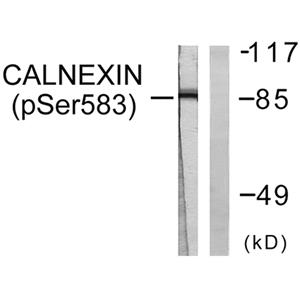 Calnexin (phospho Ser583)兔多抗,Calnexin (phospho Ser583) Rabbit Polyclonal Antibody