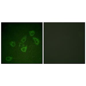 Caspase-6 (phospho Ser257)兔多抗,Caspase-6 (phospho Ser257) Rabbit Polyclonal Antibody