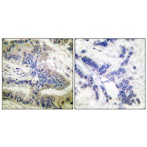 Caspase-6 (phospho Ser257)兔多抗,Caspase-6 (phospho Ser257) Rabbit Polyclonal Antibody