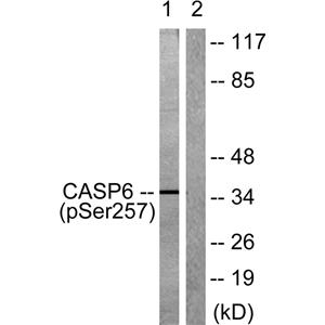 Caspase-6 (phospho Ser257)兔多抗,Caspase-6 (phospho Ser257) Rabbit Polyclonal Antibody