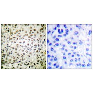 Cdk2/Cdc2 (phospho Thr160)兔多抗,Cdk2/Cdc2 (phospho Thr160) Rabbit Polyclonal Antibody