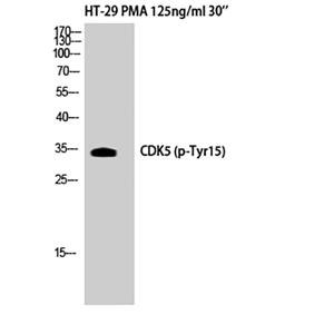 Cdk5 (phospho Tyr15)兔多抗,Cdk5 (phospho Tyr15) Rabbit Polyclonal Antibody