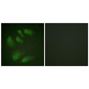 Chk1 (phospho Ser286)兔多抗,Chk1 (phospho Ser286) Rabbit Polyclonal Antibody