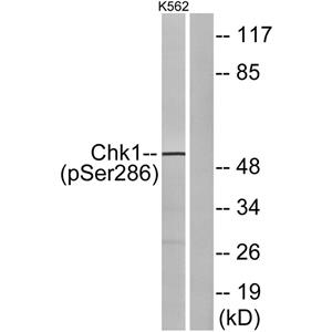 Chk1 (phospho Ser286)兔多抗,Chk1 (phospho Ser286) Rabbit Polyclonal Antibody