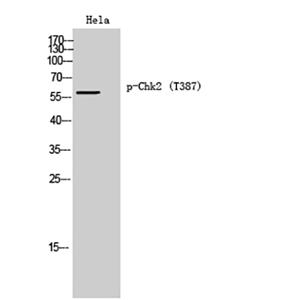 Chk2 (phospho Thr387)兔多抗,Chk2 (phospho Thr387) Rabbit Polyclonal Antibody