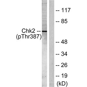 Chk2 (phospho Thr387)兔多抗,Chk2 (phospho Thr387) Rabbit Polyclonal Antibody