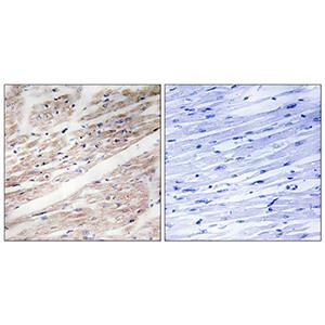 c-Kit (phospho Tyr936)兔多抗,c-Kit (phospho Tyr936) Rabbit Polyclonal Antibody
