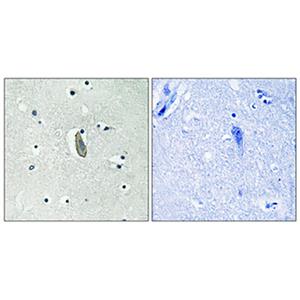 c-Kit (phospho Tyr936)兔多抗,c-Kit (phospho Tyr936) Rabbit Polyclonal Antibody