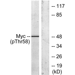c-Myc (phospho Thr58)兔多抗,c-Myc (phospho Thr58) Rabbit Polyclonal Antibody
