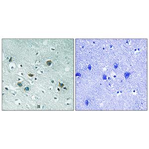 CRMP-2 (phospho Thr509)兔多抗,CRMP-2 (phospho Thr509) Rabbit Polyclonal Antibody