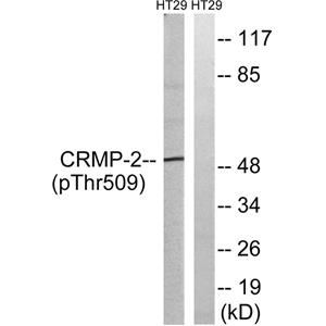 CRMP-2 (phospho Thr509)兔多抗,CRMP-2 (phospho Thr509) Rabbit Polyclonal Antibody