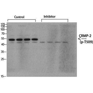 CRMP-2 (phospho Thr509)兔多抗,CRMP-2 (phospho Thr509) Rabbit Polyclonal Antibody