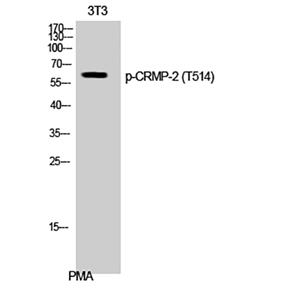 CRMP-2 (phospho Thr514)兔多抗,CRMP-2 (phospho Thr514) Rabbit Polyclonal Antibody