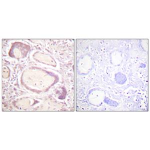 Cyclin B1 (phospho Ser147)兔多抗,Cyclin B1 (phospho Ser147) Rabbit Polyclonal Antibody