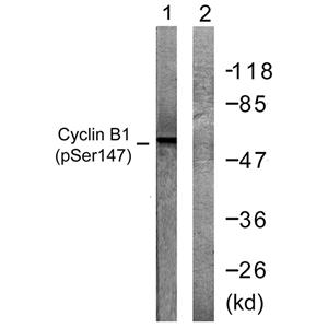Cyclin B1 (phospho Ser147)兔多抗,Cyclin B1 (phospho Ser147) Rabbit Polyclonal Antibody