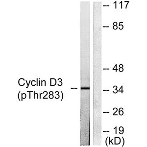 Cyclin D3 (phospho Thr283)兔多抗,Cyclin D3 (phospho Thr283) Rabbit Polyclonal Antibody