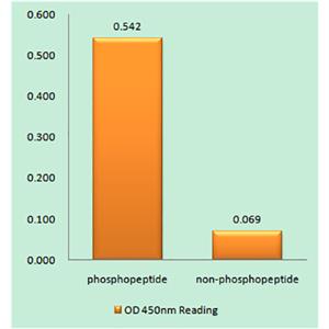 Cytokeratin 18 (phospho Ser52)兔多抗,Cytokeratin 18 (phospho Ser52) Rabbit Polyclonal Antibody