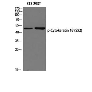 Cytokeratin 18 (phospho Ser52)兔多抗,Cytokeratin 18 (phospho Ser52) Rabbit Polyclonal Antibody