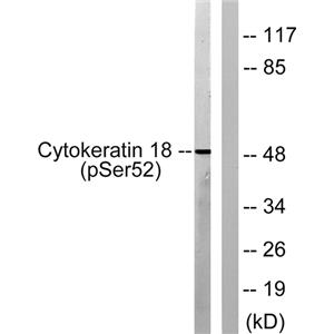 Cytokeratin 18 (phospho Ser52)兔多抗,Cytokeratin 18 (phospho Ser52) Rabbit Polyclonal Antibody