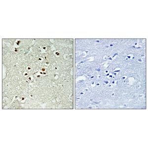 DNA Ligase IV (phospho Thr650)兔多抗,DNA Ligase IV (phospho Thr650) Rabbit Polyclonal Antibody