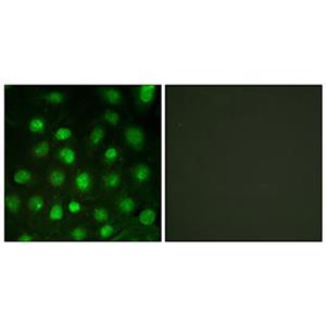 DNA-PKCS (phospho Thr2647)兔多抗,DNA-PKCS (phospho Thr2647) Rabbit Polyclonal Antibody