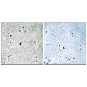 DNA-PKCS (phospho Thr2647)兔多抗,DNA-PKCS (phospho Thr2647) Rabbit Polyclonal Antibody