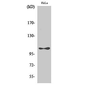 eEF2K (phospho Ser366)兔多抗,eEF2K (phospho Ser366) Rabbit Polyclonal Antibody