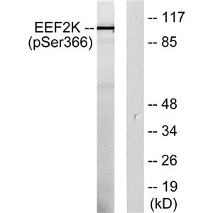 eEF2K (phospho Ser366)兔多抗,eEF2K (phospho Ser366) Rabbit Polyclonal Antibody