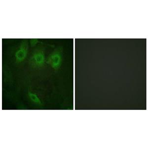EGFR (phospho Tyr1016)兔多抗,EGFR (phospho Tyr1016) Rabbit Polyclonal Antibody