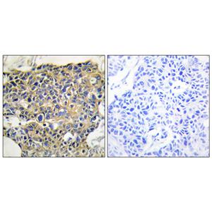 EGFR (phospho Tyr1016)兔多抗,EGFR (phospho Tyr1016) Rabbit Polyclonal Antibody