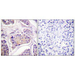 EGFR (phospho Tyr1016)兔多抗,EGFR (phospho Tyr1016) Rabbit Polyclonal Antibody